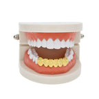 Hip-hop polished braces with gold electroplating by nowadaysfashion