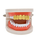 Hip-hop polished braces with gold electroplating by nowadaysfashion